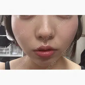 ルラ美容クリニック 広島院口コミ