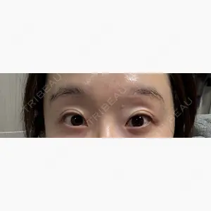 銀座リシェスクリニック口コミ