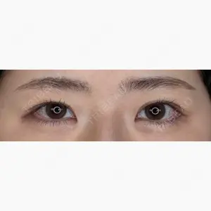アリエル美容クリニック 大宮院口コミ