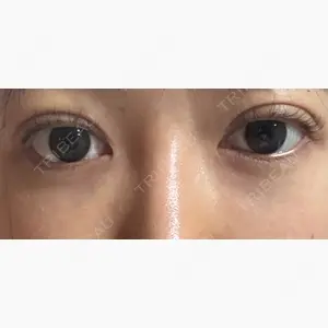 NARU Beauty Clinic 【ナルクリ】口コミ