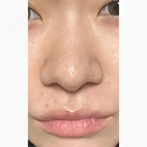 東京美専クリニック口コミ