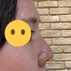 東京形成美容外科 船橋院口コミ
