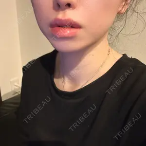 PRO CLINIC プロクリニック 銀座院口コミ