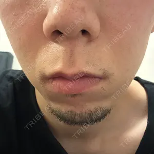 大美会クリニック 梅田院口コミ