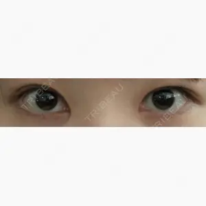 いちのせ形成外科・皮膚科 眼瞼＆フェイスクリニック口コミ