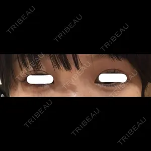PRO CLINIC プロクリニック 銀座院口コミ