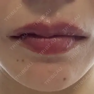 TCB東京中央美容外科 名古屋栄院口コミ