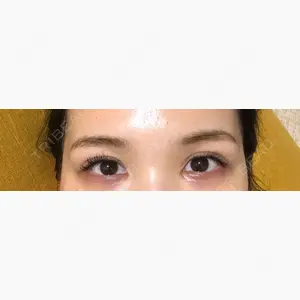 HAAB×DREAM BEAUTY CLINIC 大阪梅田院口コミ