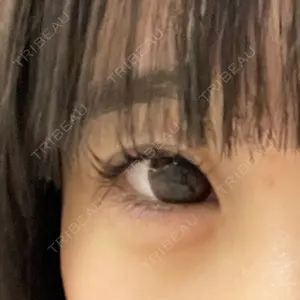 フィラークリニック 新宿院口コミ