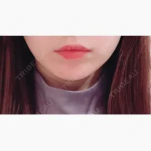 MIO CLINIC 梅田院口コミ
