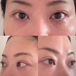 EMMO FACE CLINIC 東京三田院口コミ