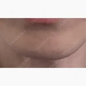 湘南美容クリニック 名古屋栄院口コミ