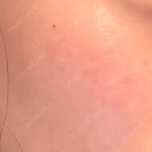 DAILY SKIN CLINIC 福岡院口コミ