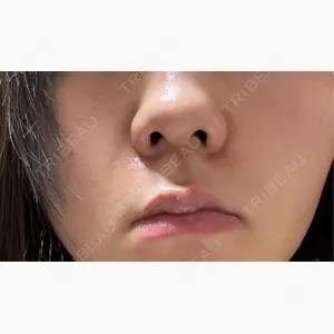 おおたかの森ビューティークリニック口コミ