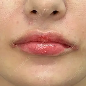 ルラ美容クリニック 渋谷本院口コミ
