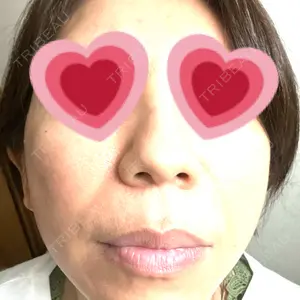 ルラ美容クリニック 千葉院口コミ
