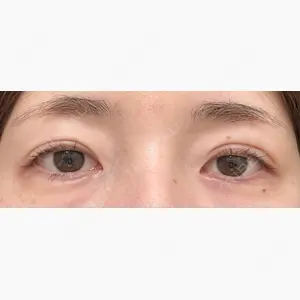 東京シンデレラ美容外科 新宿院口コミ