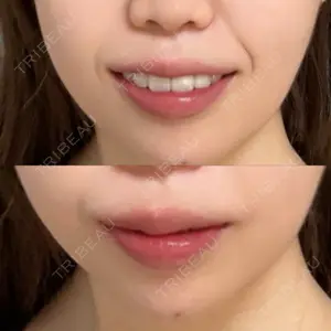 PRO CLINIC プロクリニック 銀座院口コミ