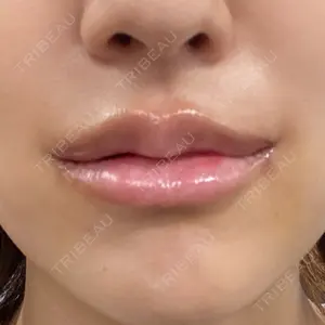 R Beauty CLINIC 銀座院口コミ