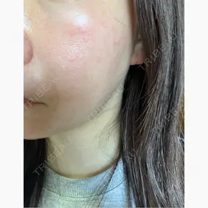ルラ美容クリニック 仙台院口コミ
