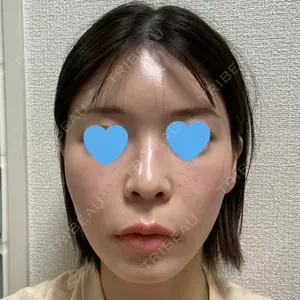 BiBiクリニック口コミ