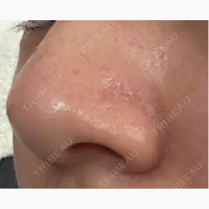 ライズワン美容皮膚科クリニック口コミ