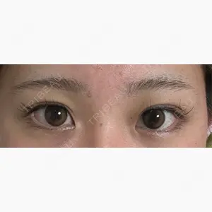 HAAB×DREAM BEAUTY CLINIC 大阪梅田院口コミ