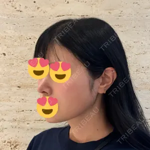 LUHO（ルホ）美容外科口コミ