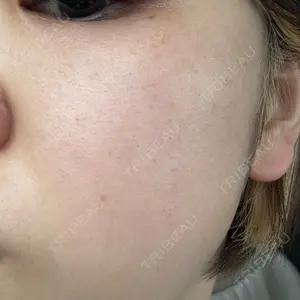 PureMe Skin Clinic（ピュアミースキンクリニック麻布）口コミ