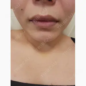 アムルーズ美容外科クリニック 横浜院口コミ