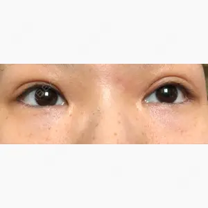 東京皮膚科・形成外科 (銀座いけだクリニック)口コミ