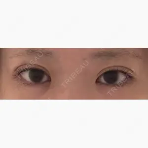 LUHO（ルホ）美容外科口コミ
