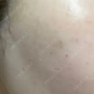 Natural Skin Clinic 笹塚院口コミ