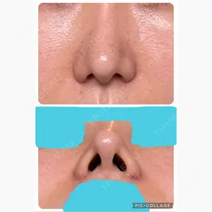 TJ美容外科口コミ