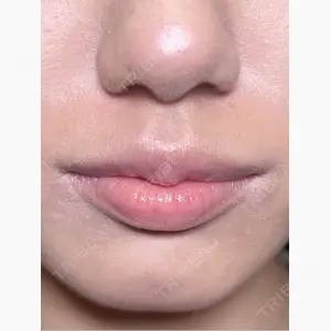 R Beauty CLINIC 銀座院口コミ
