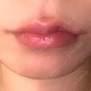 ルラ美容クリニック 名古屋本院口コミ