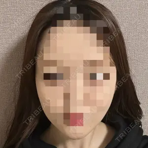 セギム美容整形外科口コミ