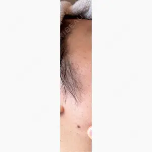 ルラ美容クリニック 福岡院口コミ