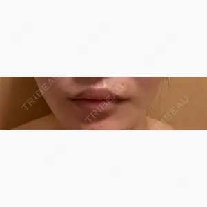 ルラ美容クリニック 渋谷本院口コミ