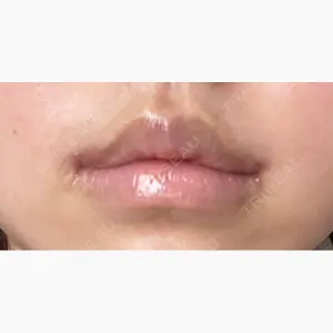 R Beauty CLINIC 銀座院口コミ