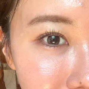 藤・ナチュレ美容クリニック 銀座院口コミ