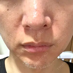 ルラ美容クリニック 名古屋本院口コミ