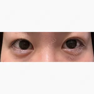 プラザ美容外科口コミ