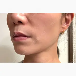 ルラ美容クリニック 大宮院 / ルラスキンクリニック 大宮院口コミ