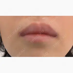 eクリニック 福岡院口コミ