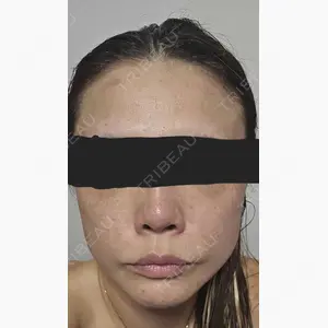 MIO CLINIC 梅田院口コミ