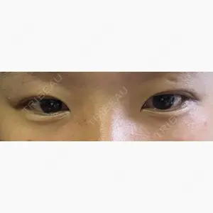 NARU Beauty Clinic 【ナルクリ】口コミ