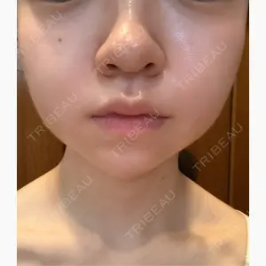 ルラ美容クリニック 広島院口コミ