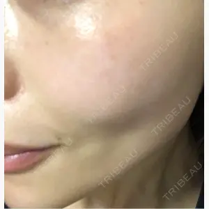 Ledian Clinic六本木口コミ
