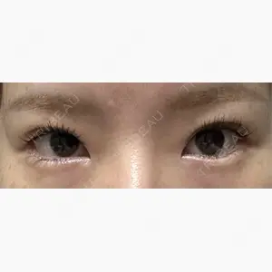 LUHO（ルホ）美容外科口コミ